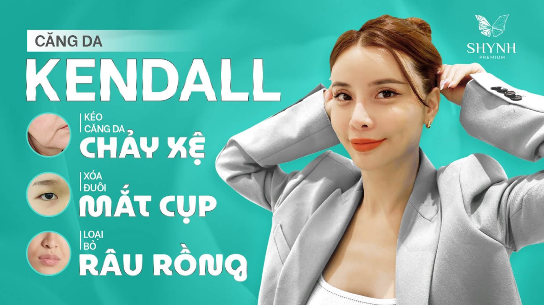 Căng da Kendall