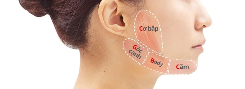 Quy trình phẫu thuật tạo hình góc hàm