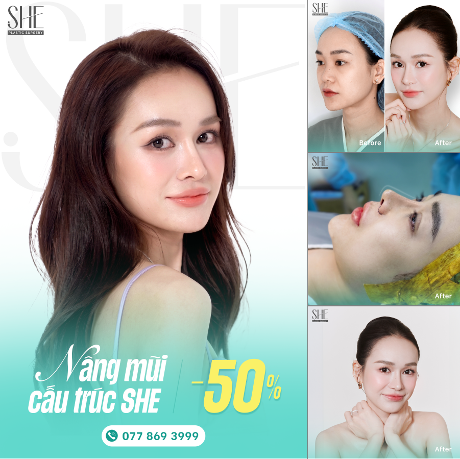 Nâng Mũi Cấu Trúc Tại SHE Giảm 50%