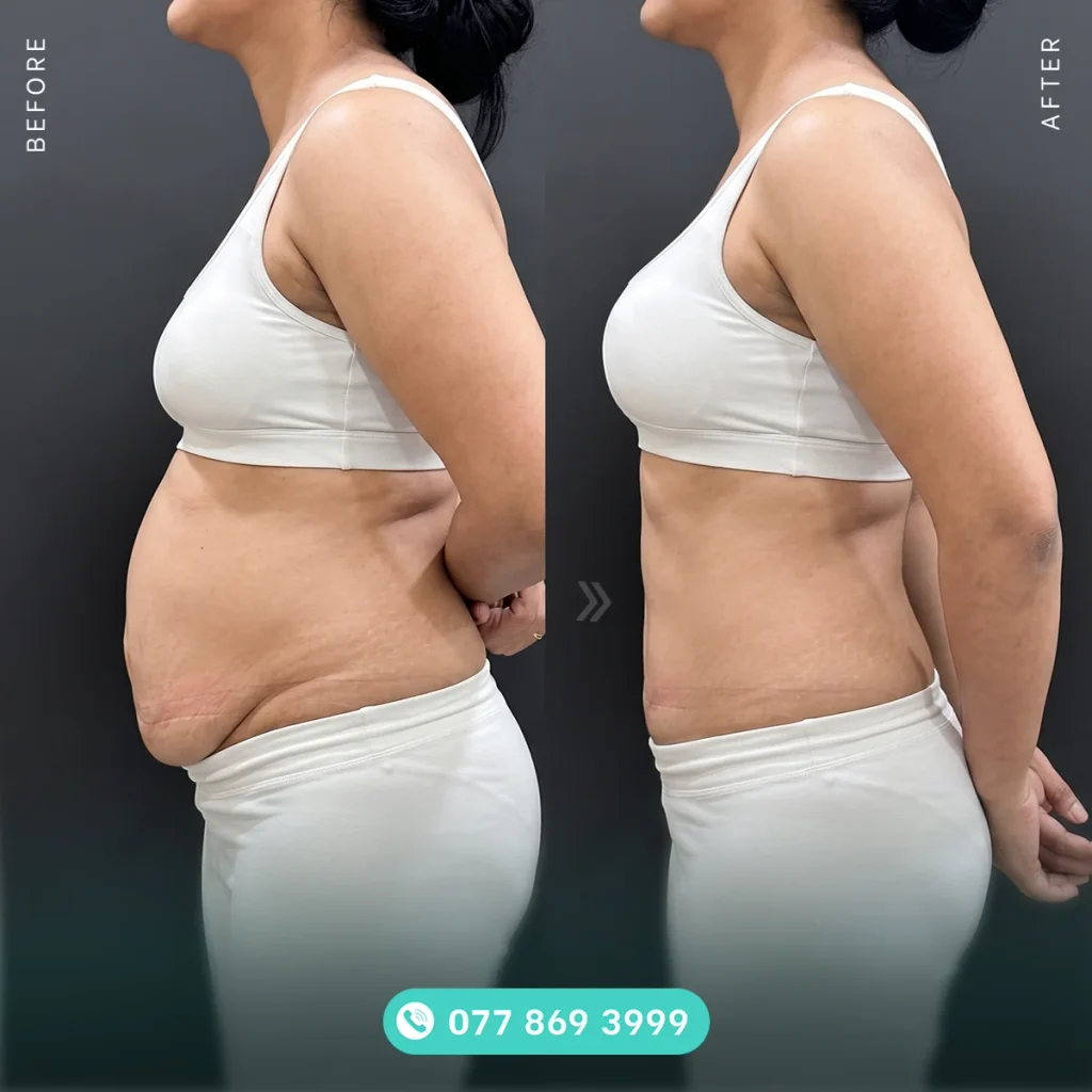 Trải nghiệm các dịch vụ nâng cấp diện mạo không mất phí tại SHE By SHYNH Plastic Surgery