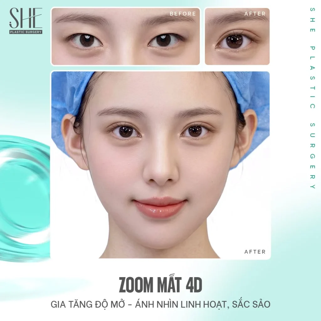 Những điều cần lưu ý trước khi thực hiện Zoom Mắt 4D