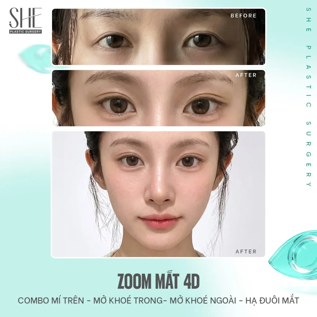 Tùy tình trạng, khách hàng có thể được cân nhắc một hoặc nhiều kỹ thuật.