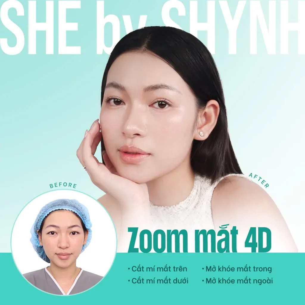 ZOOM MẮT 4D: Giải pháp cải thiện mí mắt, tạo ánh nhìn hài hòa