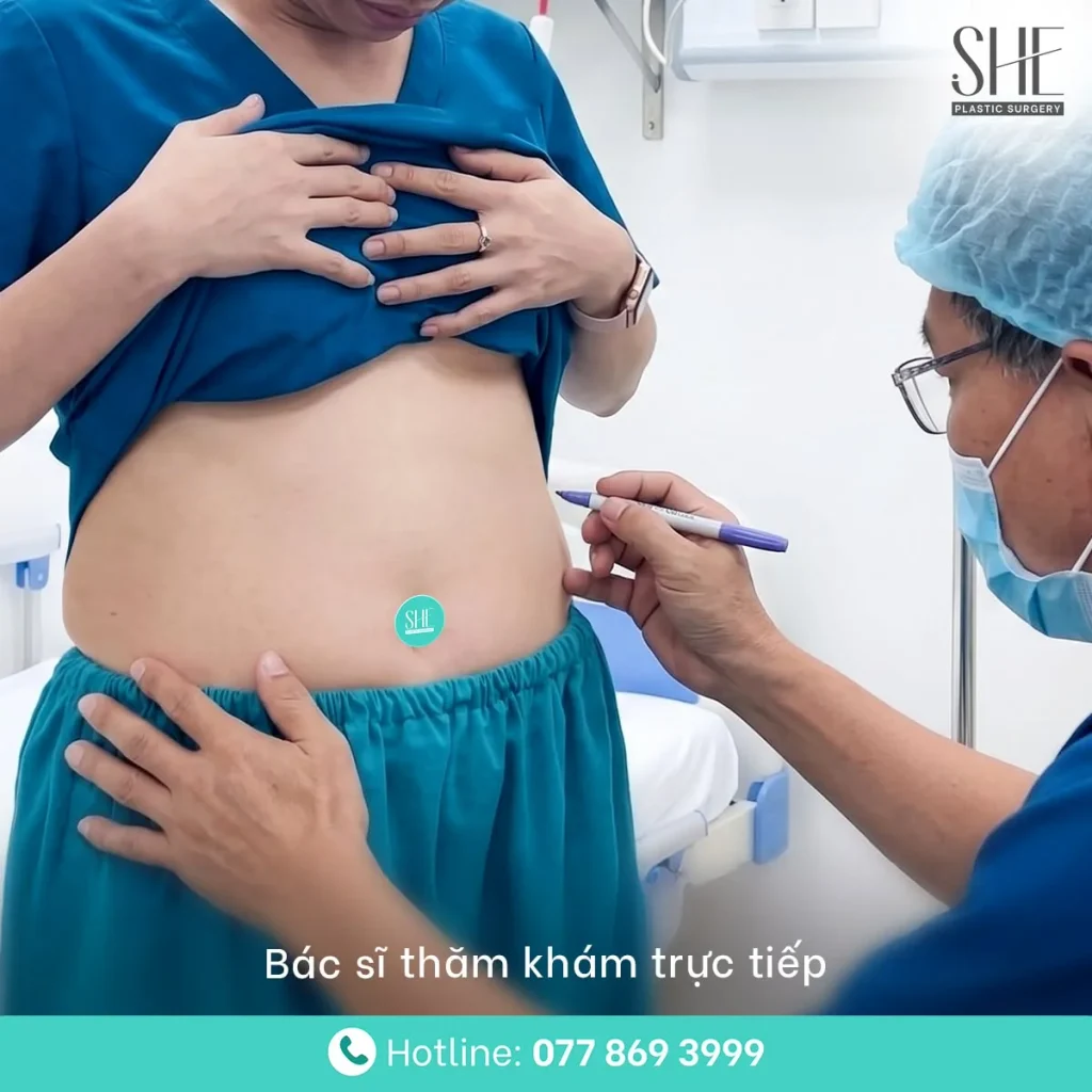 Bác sĩ tư vấn phương pháp căng da bụng phù hợp