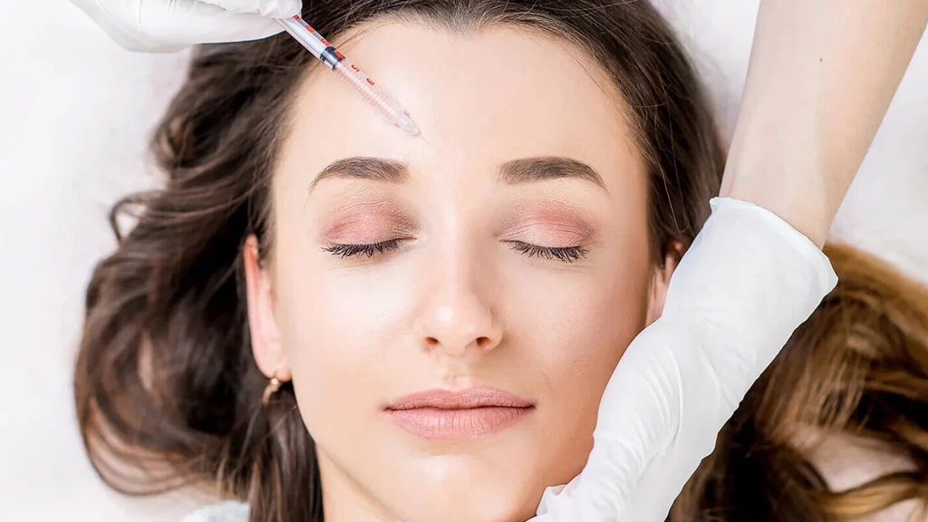 Cấy mỡ mặt bằng mỡ tự thân