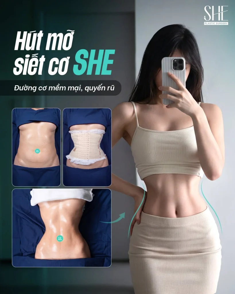 Hút mỡ bụng tại SHE by SHYNH