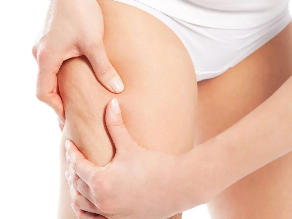 Hút mỡ đùi hướng đến cải thiện đường nét và tỷ lệ đôi chân