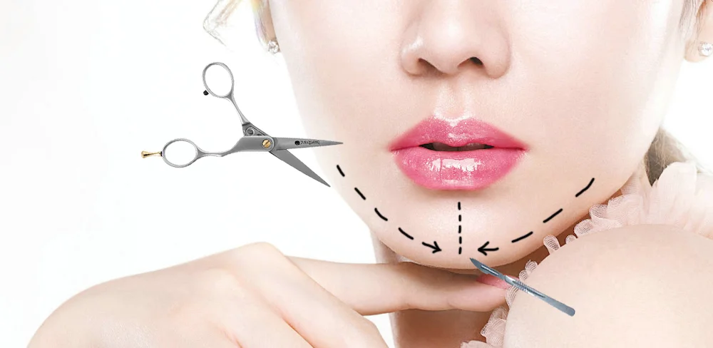 Tái phẫu thuật độn cằm giúp điều chỉnh dáng cằm chưa hài hòa